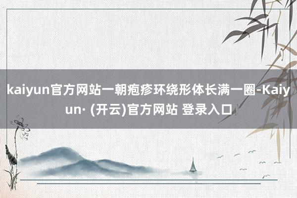 kaiyun官方网站一朝疱疹环绕形体长满一圈-Kaiyun· (开云)官方网站 登录入口